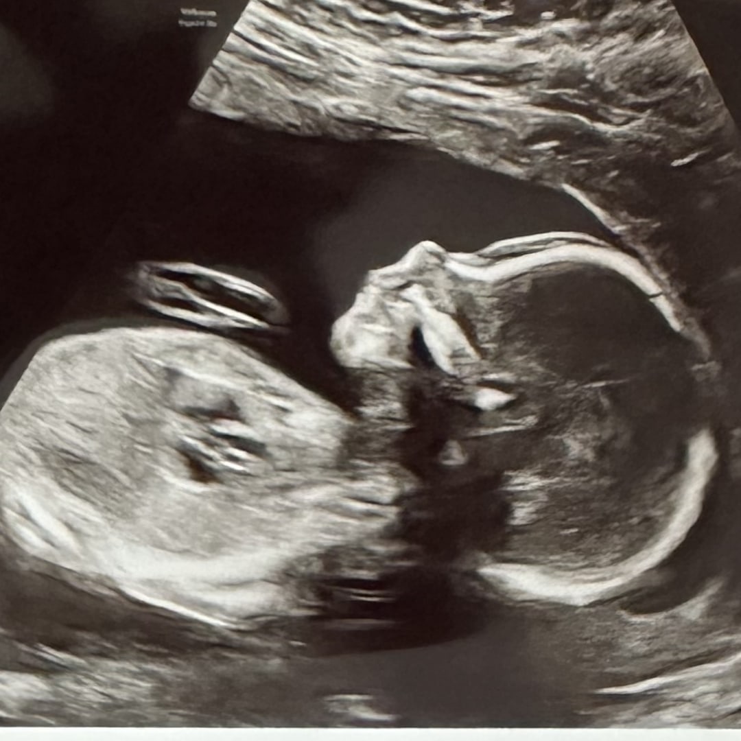Photo shared by Jayde for their Babylist baby registry.