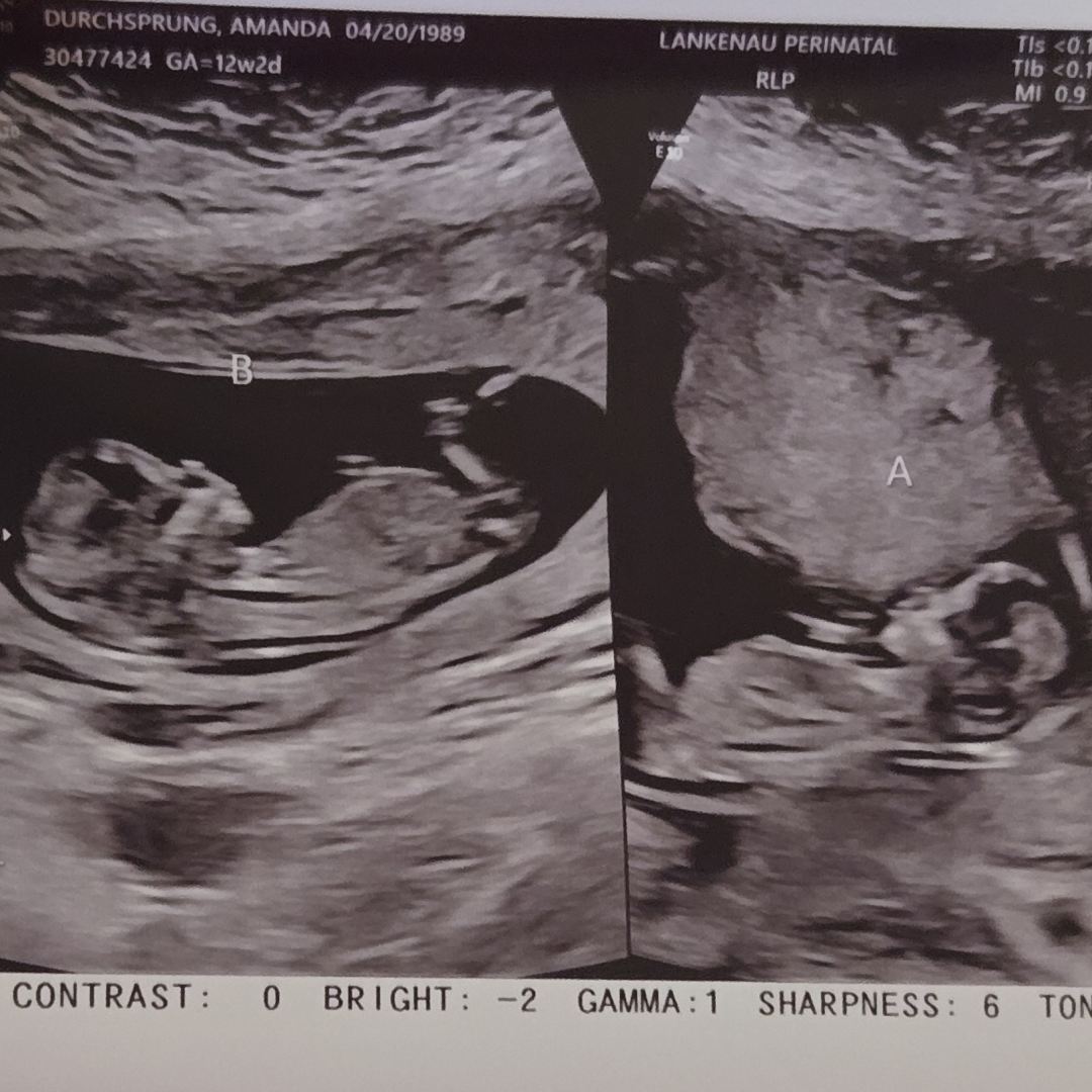 Photo shared by Amanda for their Babylist baby registry.
