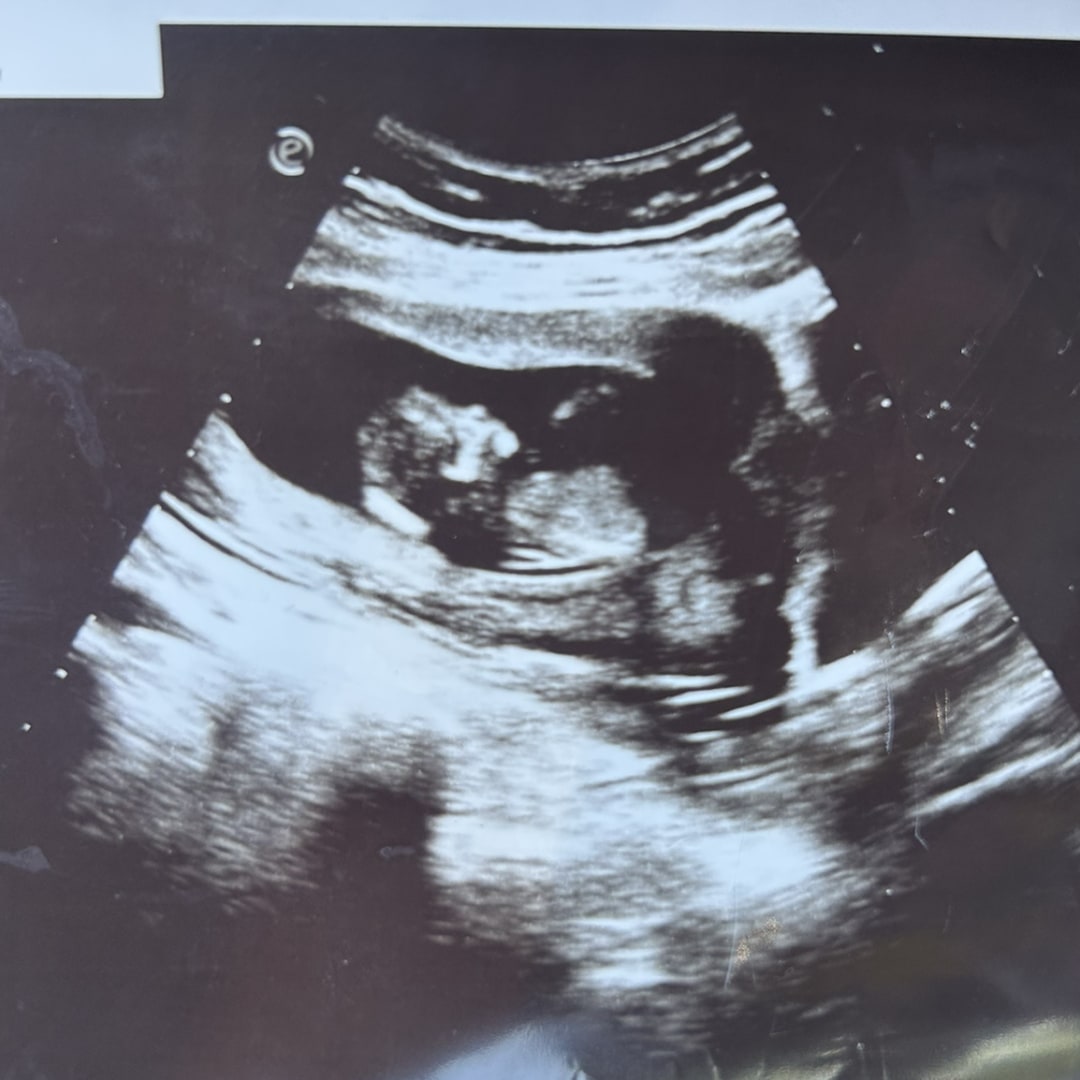 Photo shared by Ariel for their Babylist baby registry.
