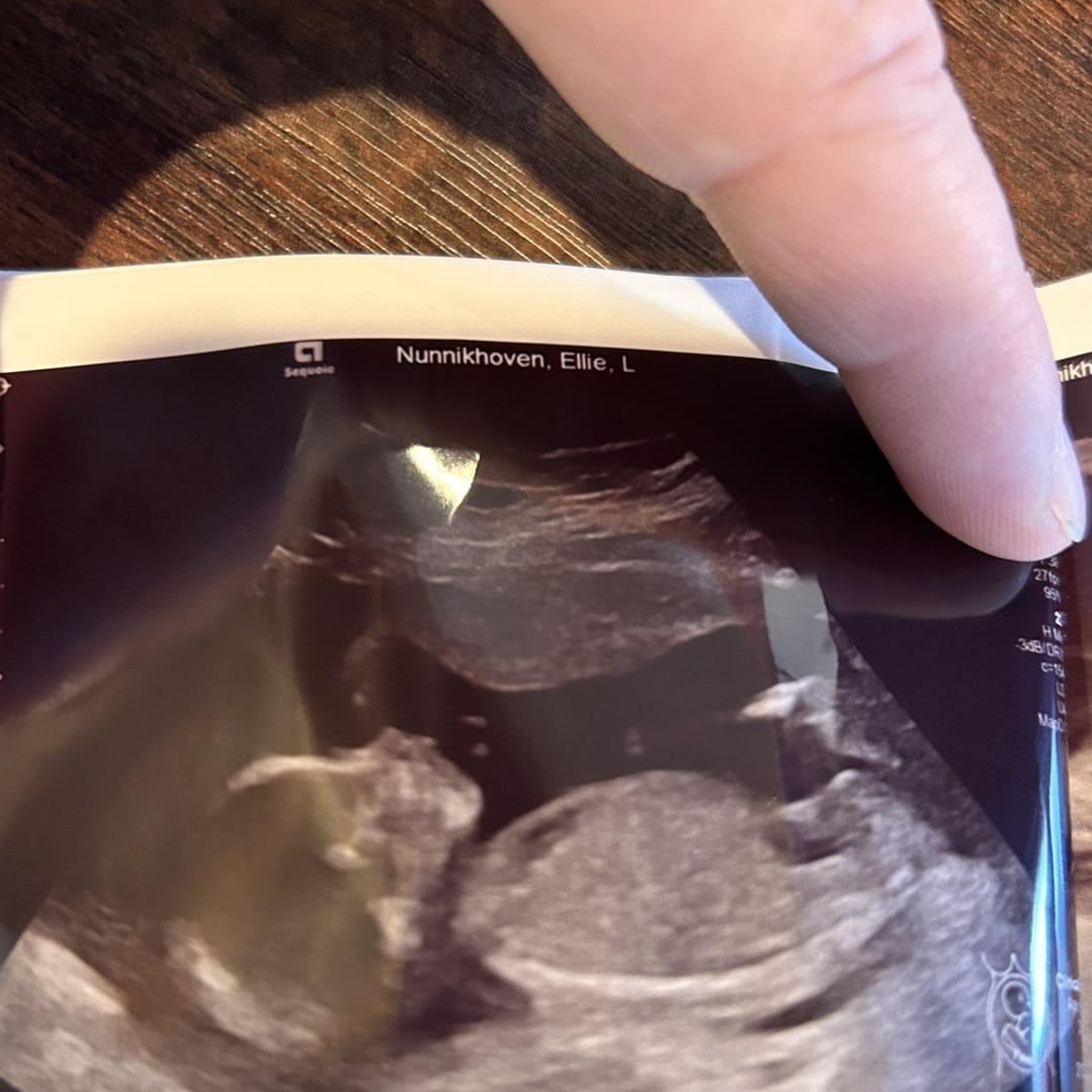 Photo shared by Ellie for their Babylist baby registry.