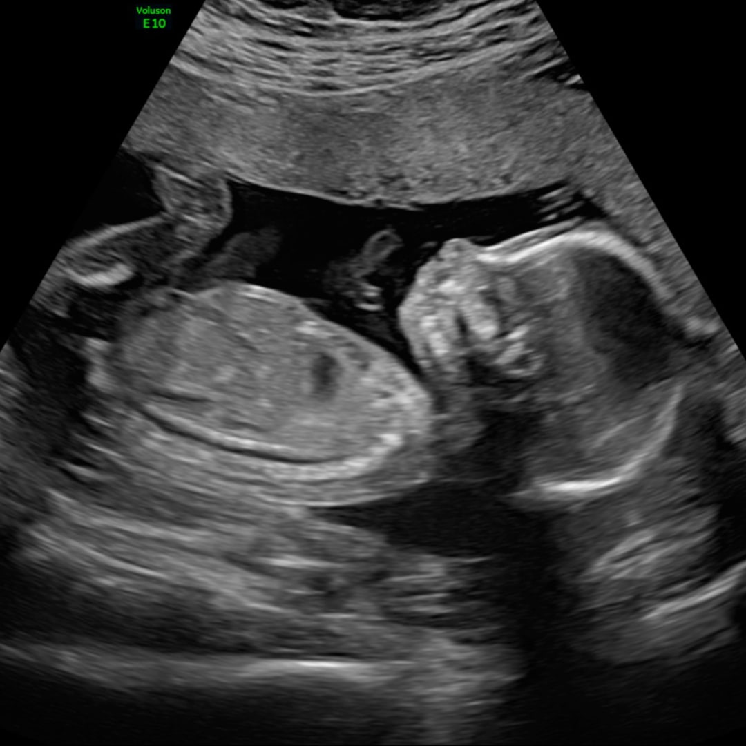 Photo shared by Natalie for their Babylist baby registry.