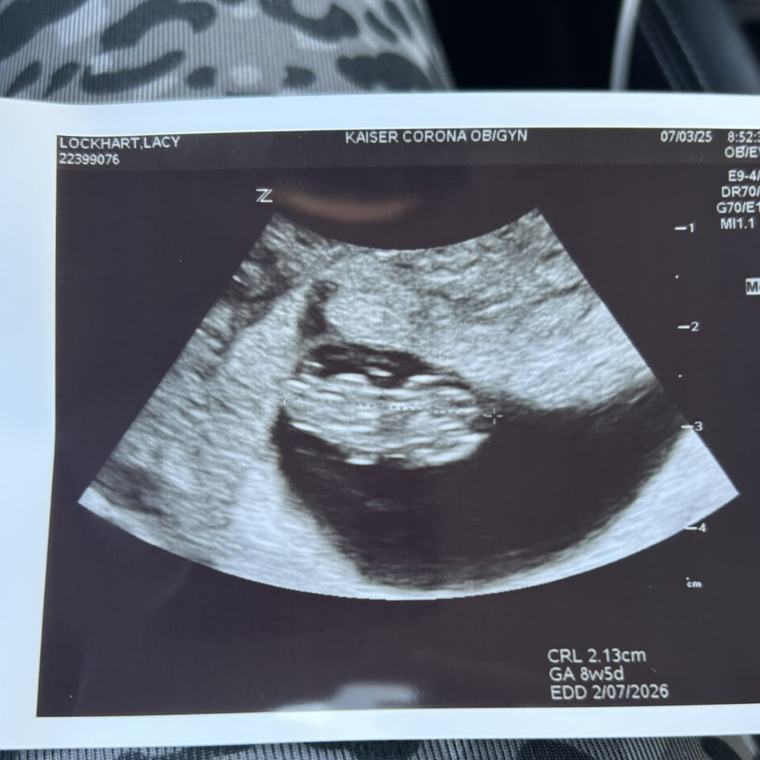 Photo shared by Lacy for their Babylist baby registry.