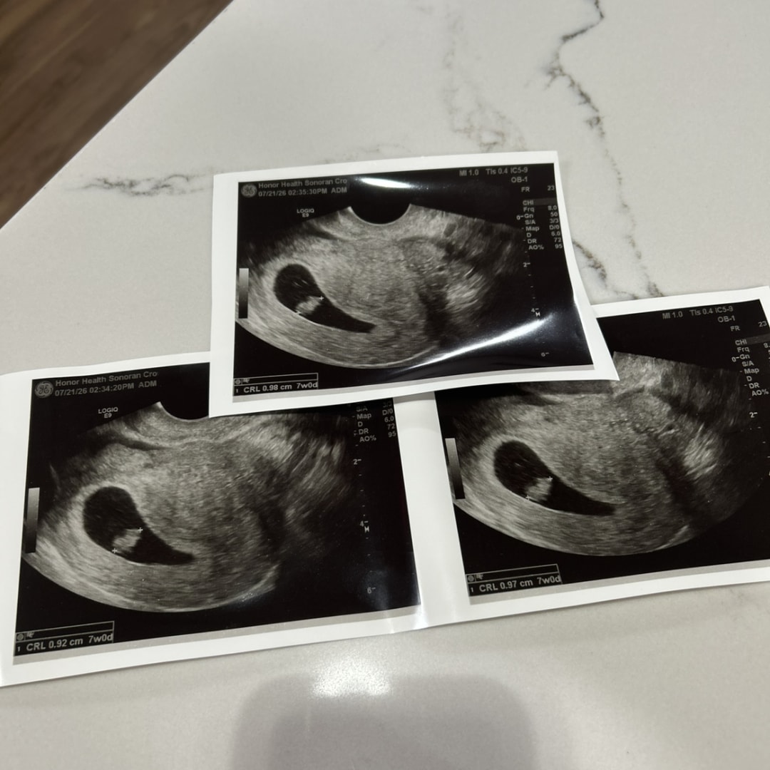 Photo shared by Allison for their Babylist baby registry.
