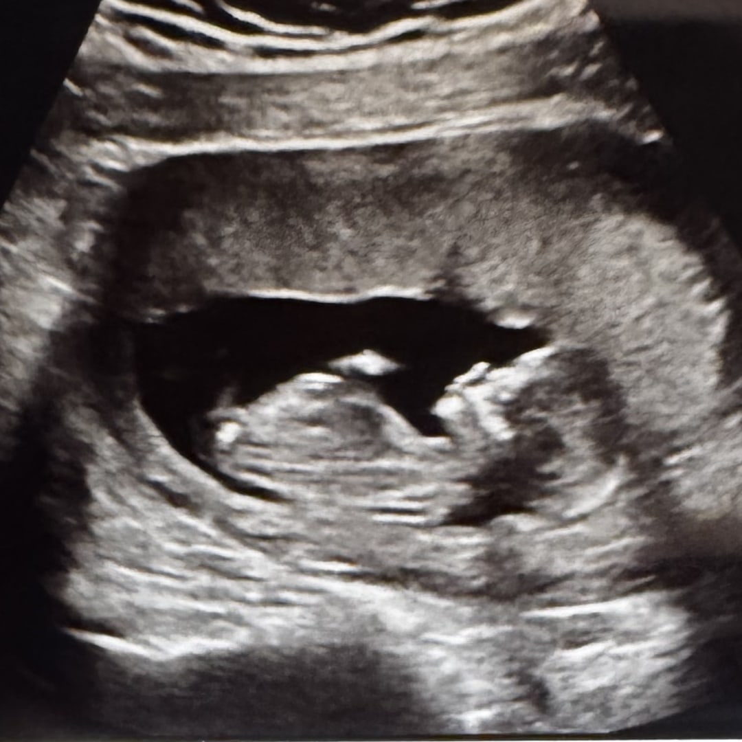 Photo shared by Erin for their Babylist baby registry.