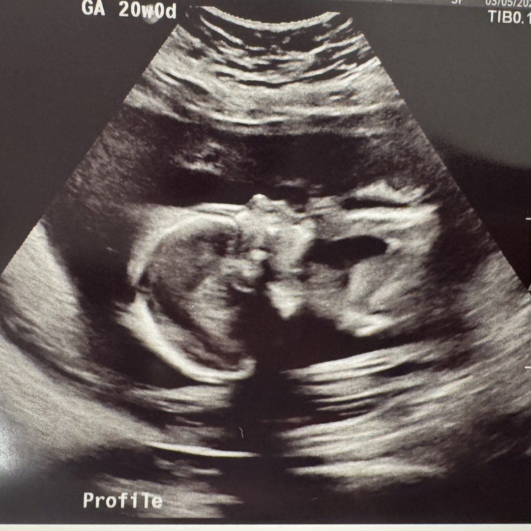 Photo shared by Sarah for their Babylist baby registry.