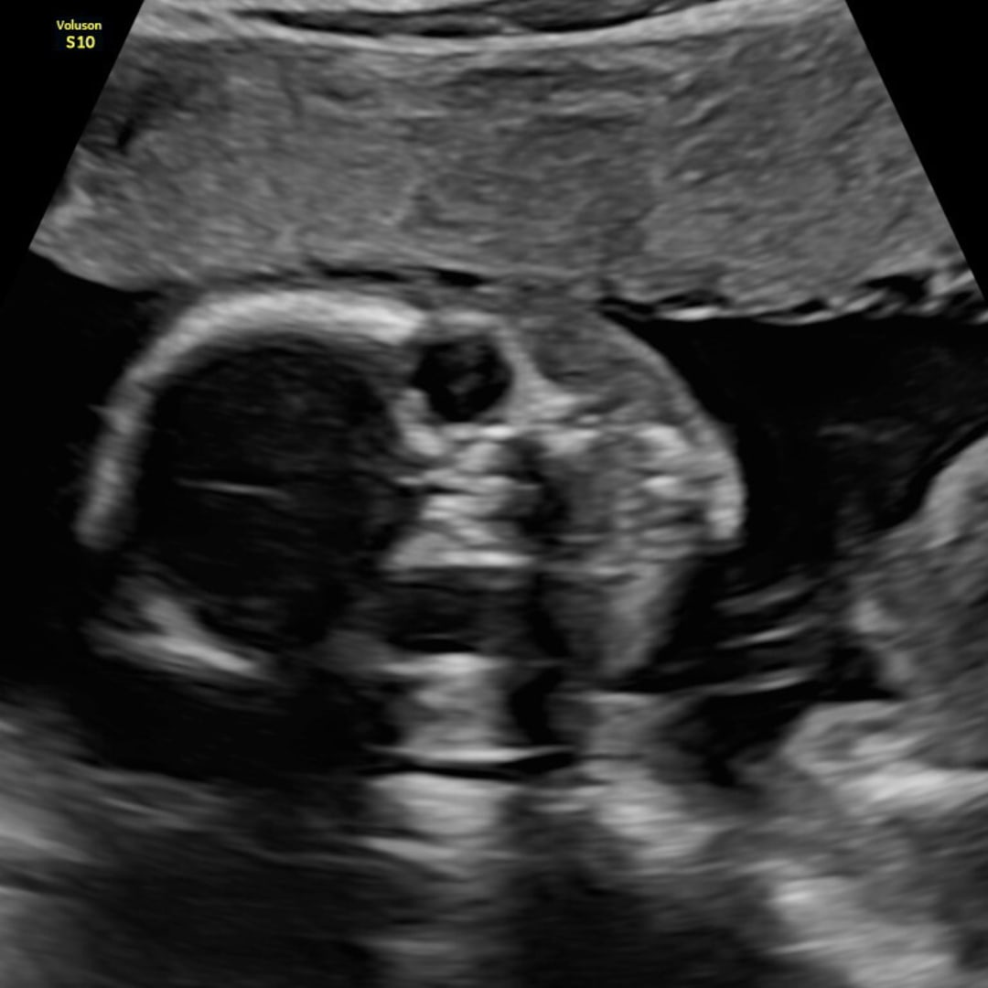 Photo shared by Tylee for their Babylist baby registry.