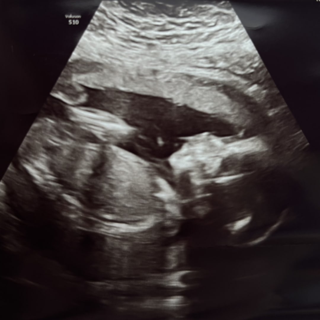Photo shared by Kate for their Babylist baby registry.