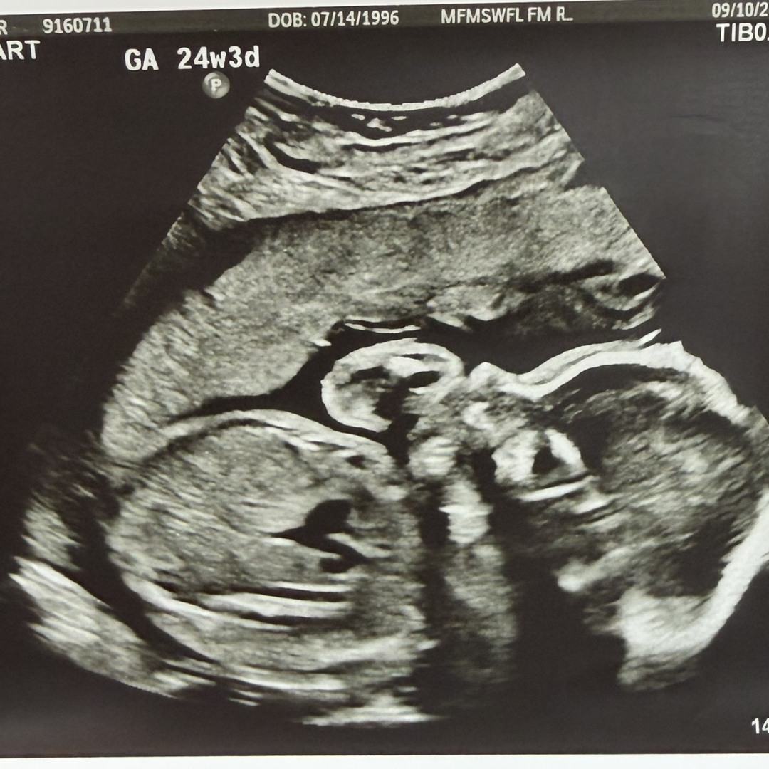 Photo shared by Carissa for their Babylist baby registry.