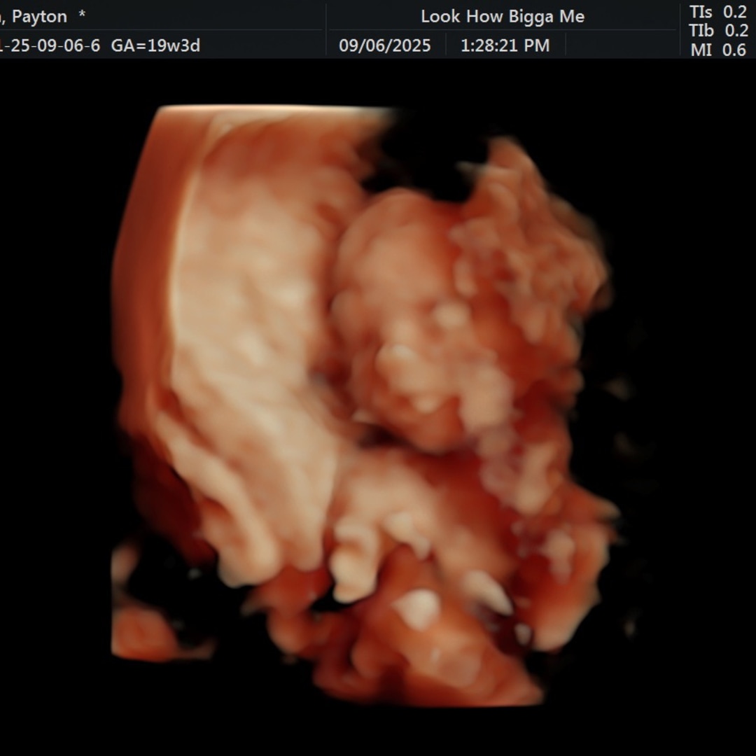 Photo shared by Payton for their Babylist baby registry.