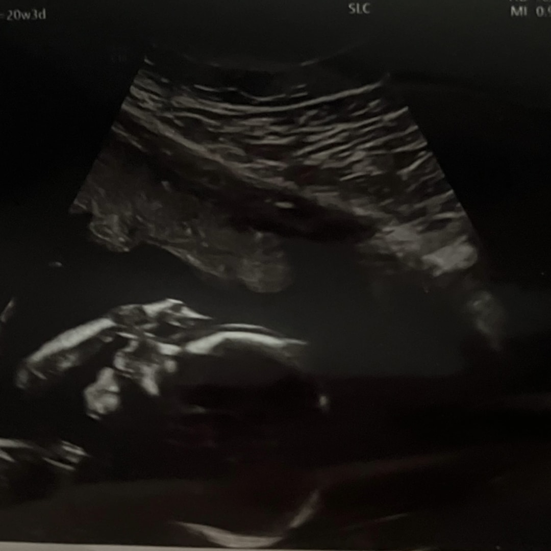 Photo shared by Siren for their Babylist baby registry.