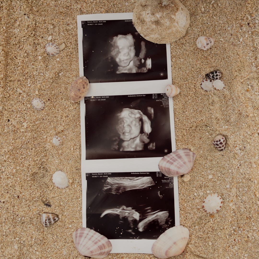 Photo shared by Mariah Josephine for their Babylist baby registry.