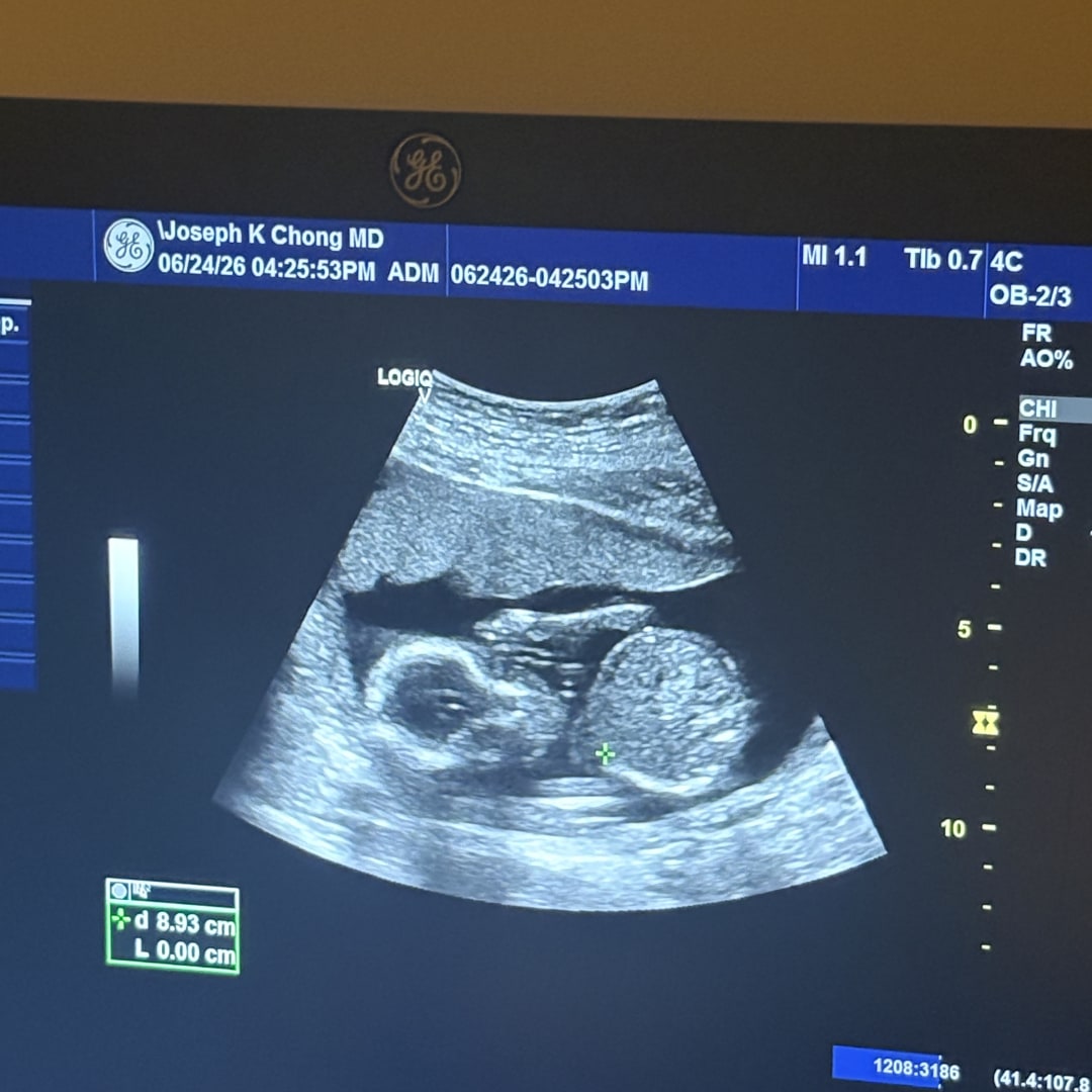 Photo shared by Nayea for their Babylist baby registry.