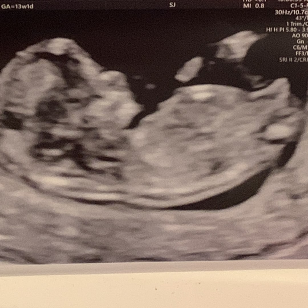 Photo shared by Geraldine for their Babylist baby registry.