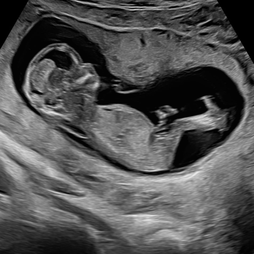 Photo shared by Kamalia for their Babylist baby registry.