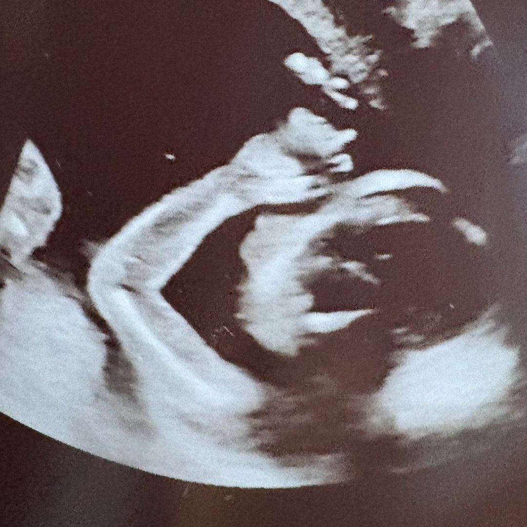 Photo shared by Haylie for their Babylist baby registry.