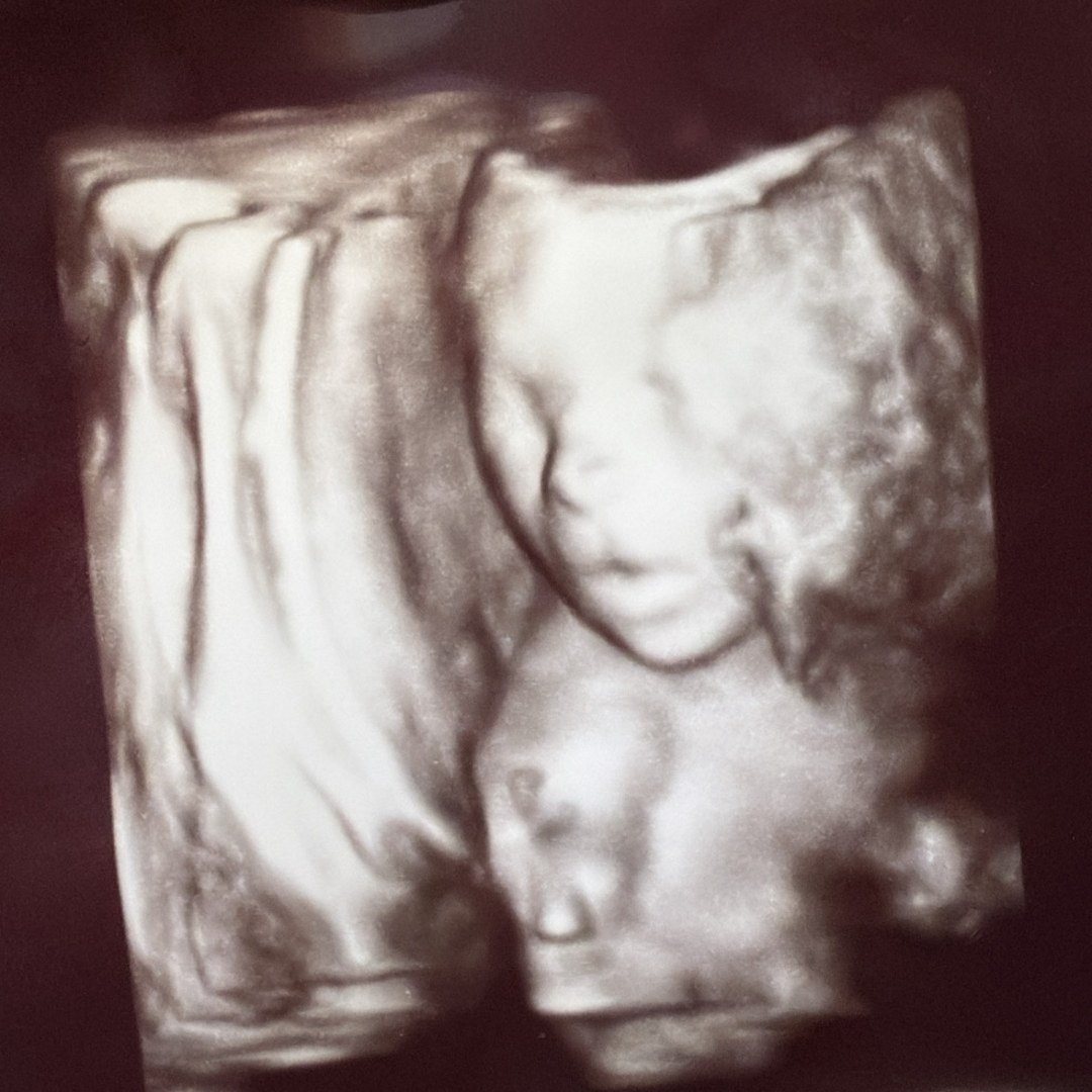 Photo shared by Megan for their Babylist baby registry.
