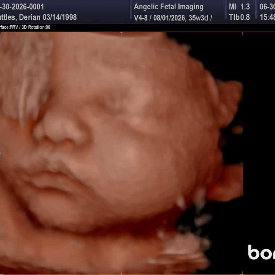 Photo shared by Derian for their Babylist baby registry.