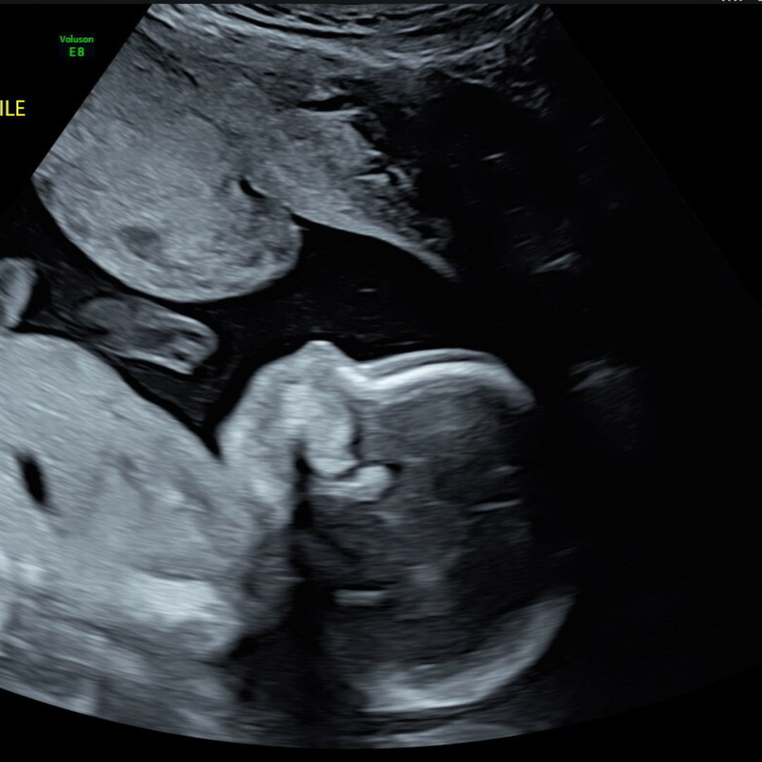 Photo shared by Anneliese for their Babylist baby registry.