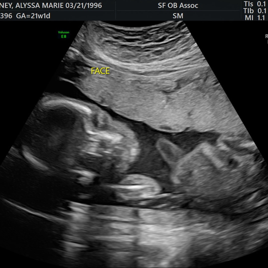 Photo shared by Alyssa for their Babylist baby registry.