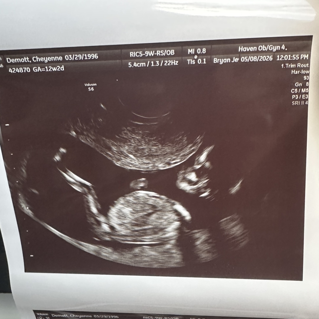 Photo shared by Cheyenne for their Babylist baby registry.