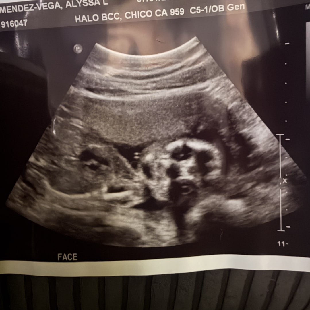 Photo shared by Alyssa for their Babylist baby registry.