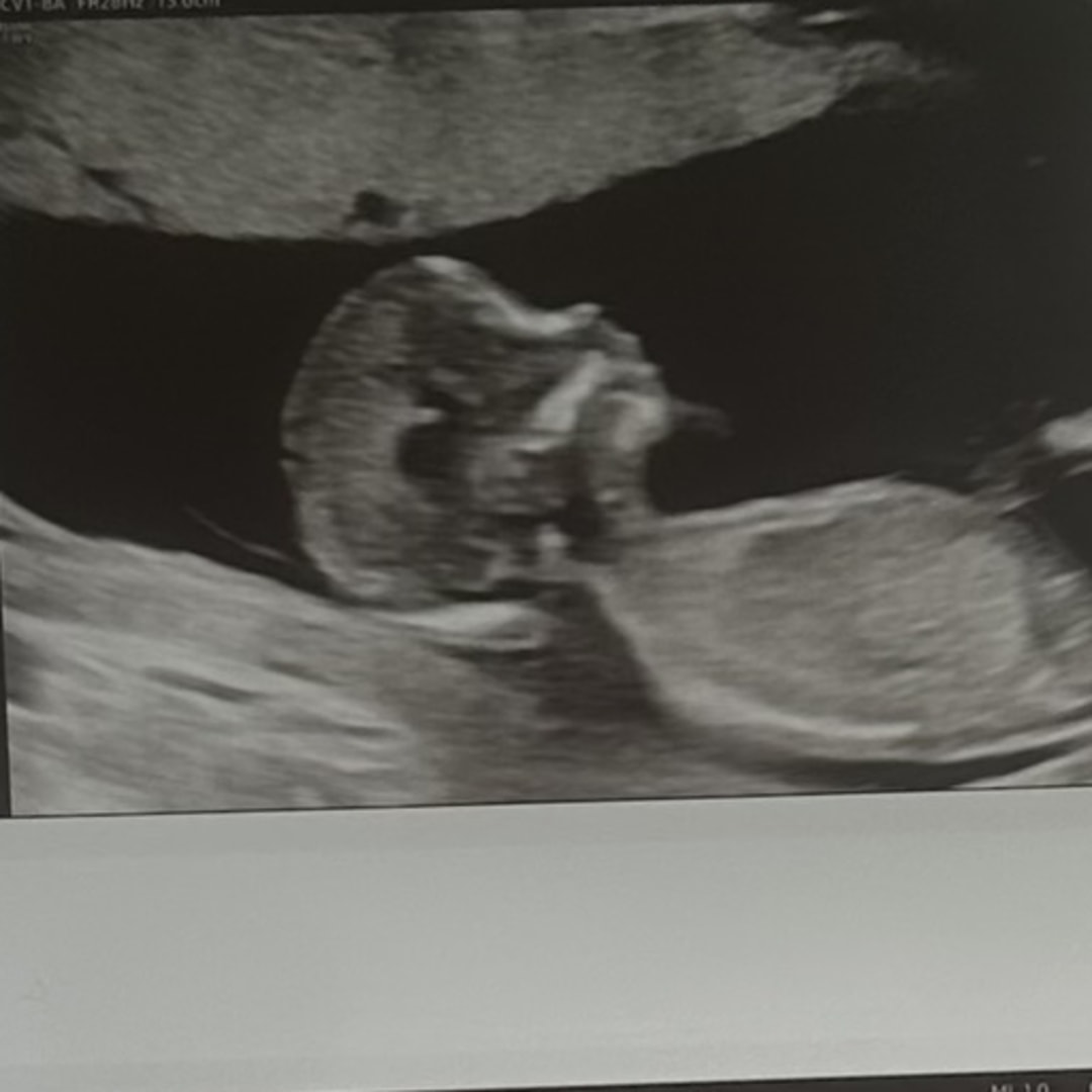 Photo shared by Caitlin for their Babylist baby registry.