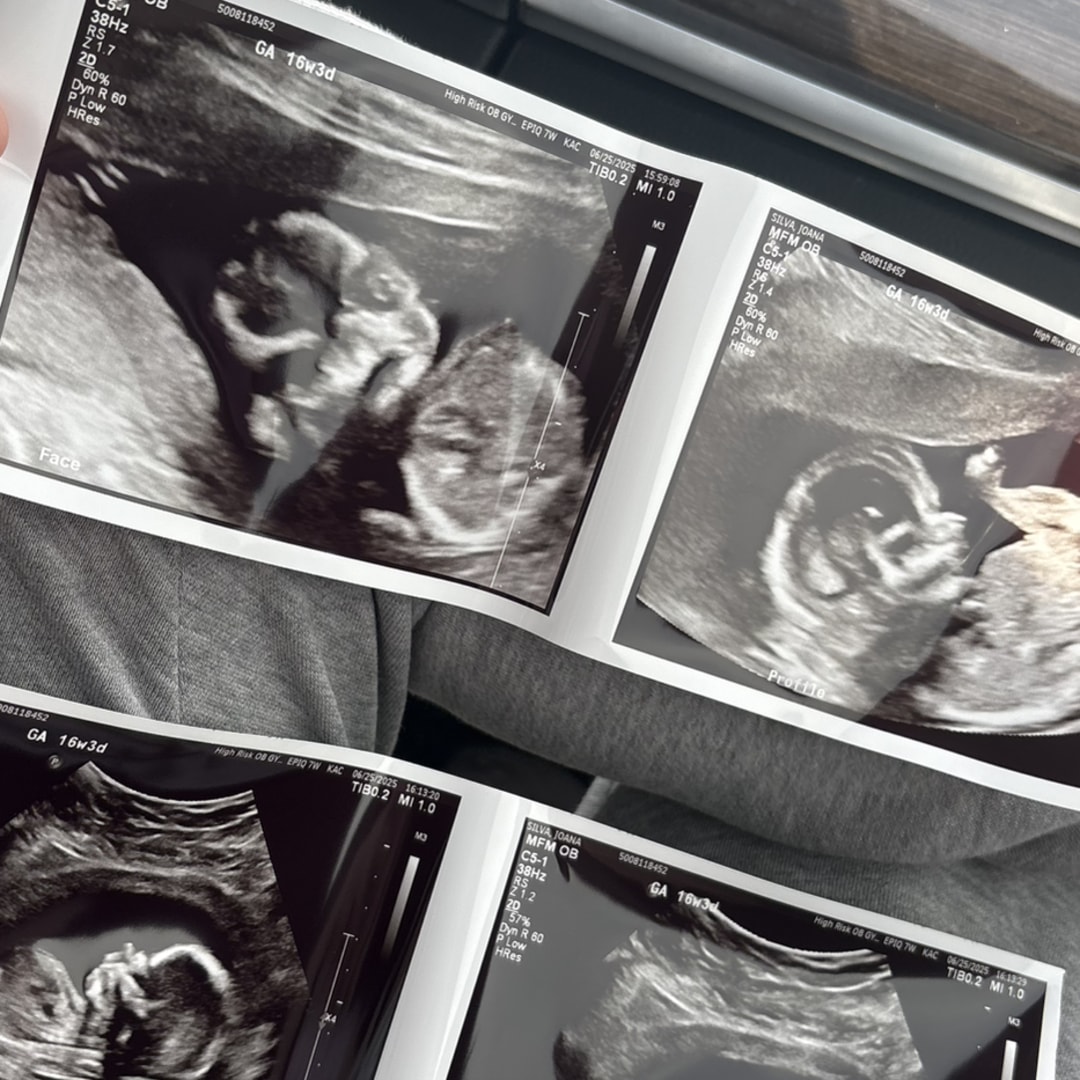 Photo shared by Joana for their Babylist baby registry.