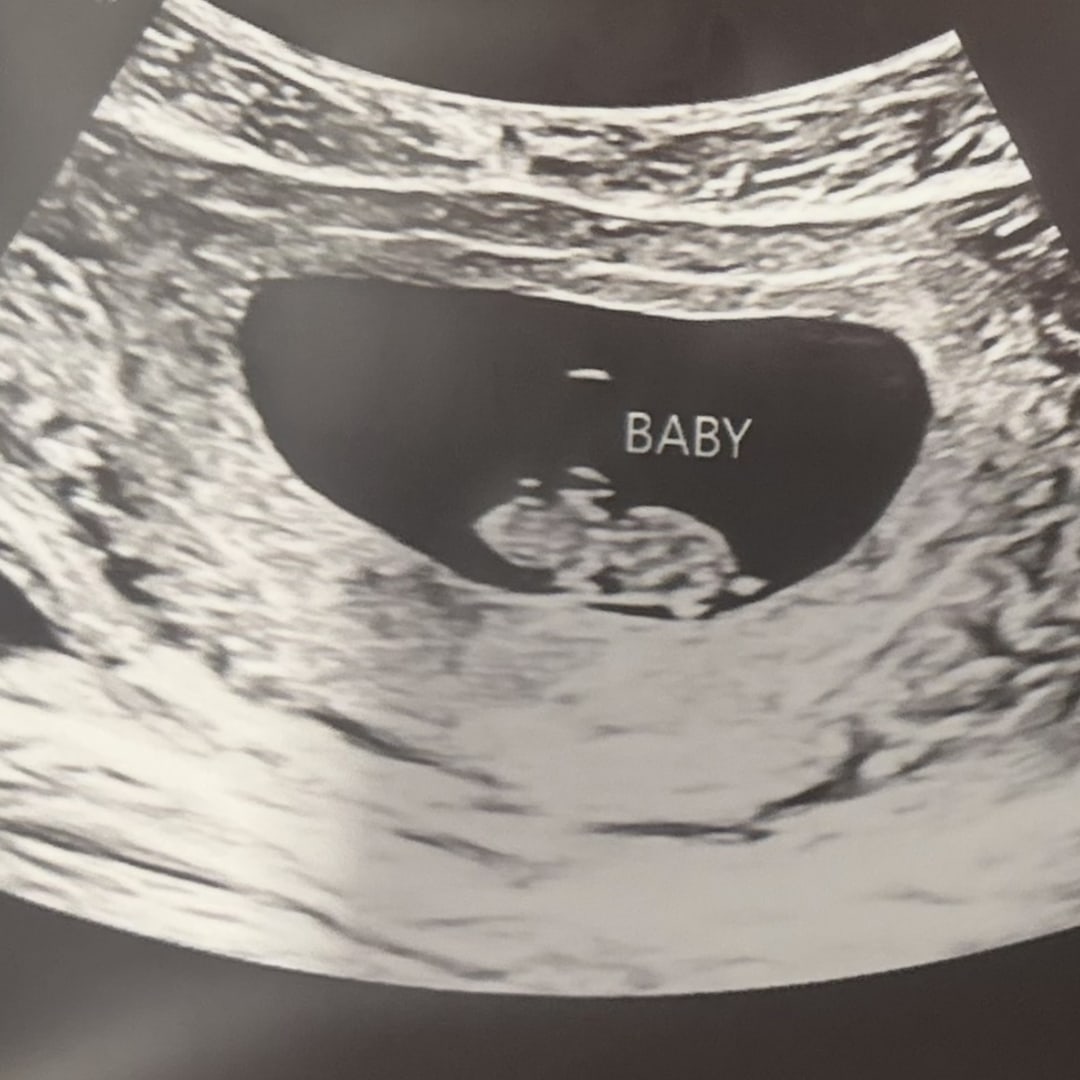 Photo shared by Trinity for their Babylist baby registry.