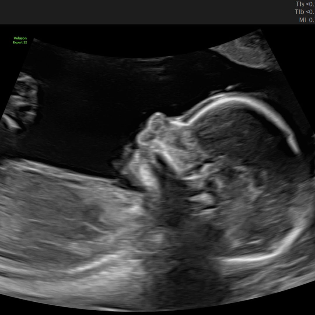 Photo shared by Ally for their Babylist baby registry.