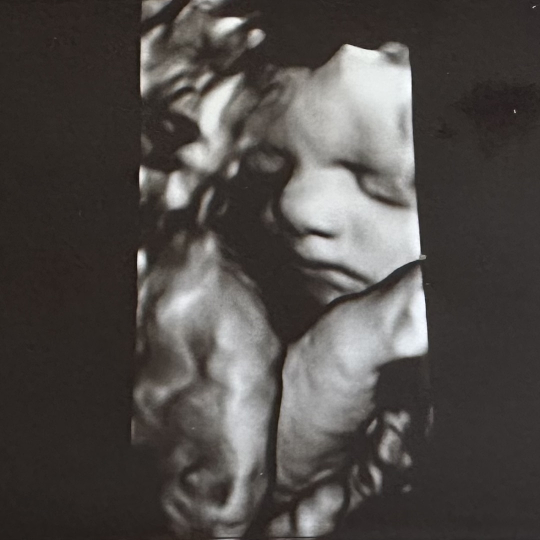 Photo shared by Hannah for their Babylist baby registry.