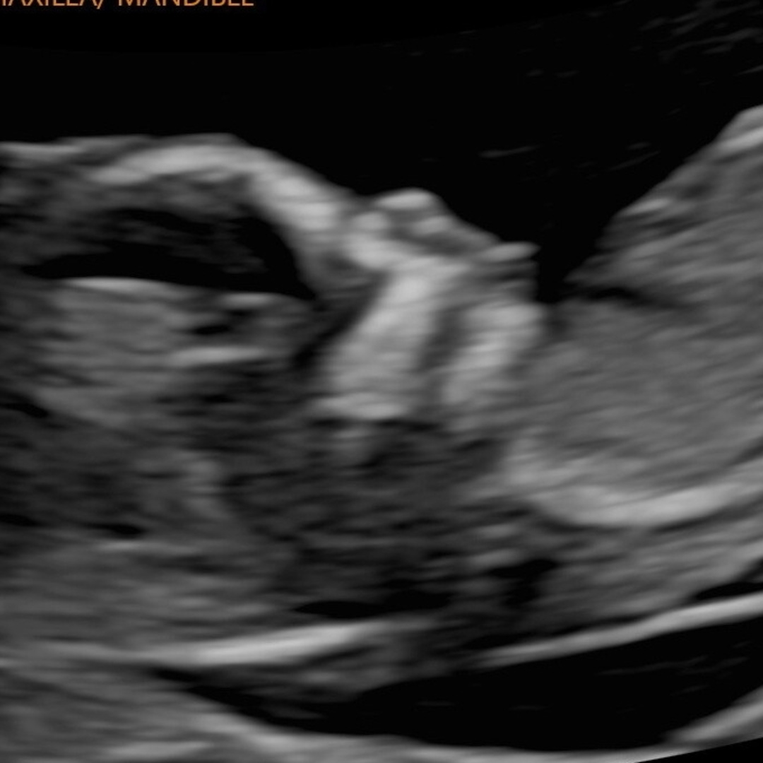 Photo shared by Dakota Star for their Babylist baby registry.