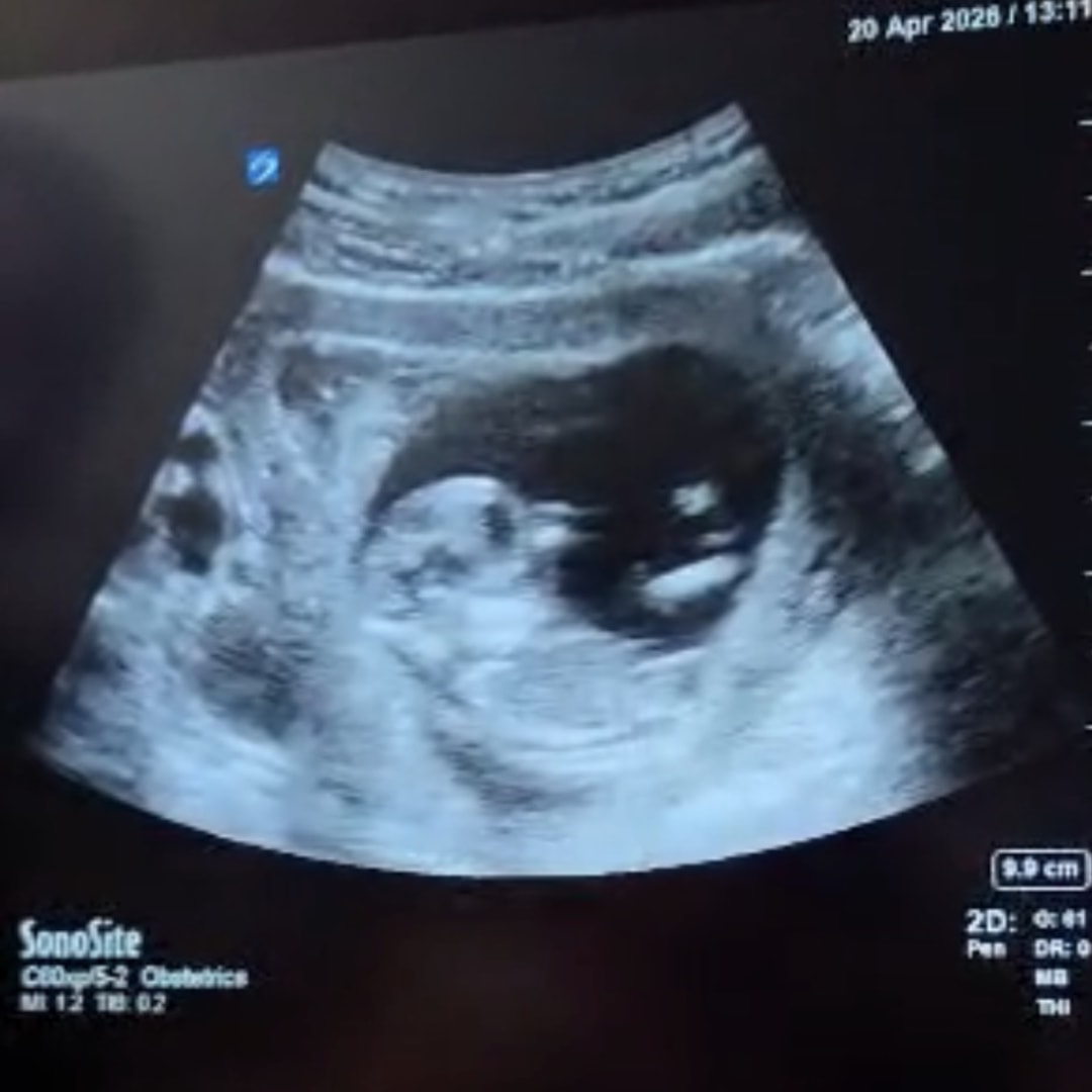 Photo shared by Halle for their Babylist baby registry.