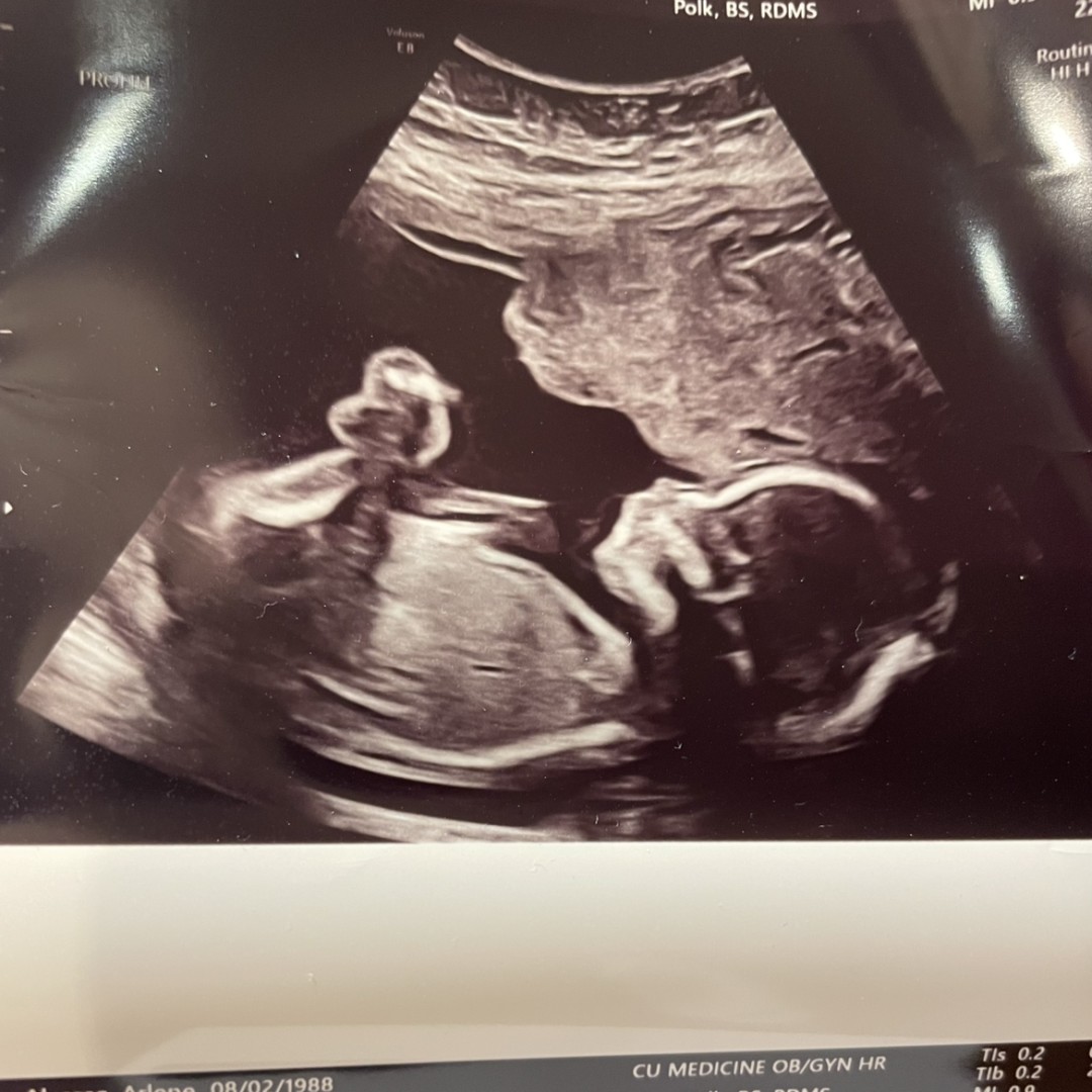 Photo shared by Arlene for their Babylist baby registry.