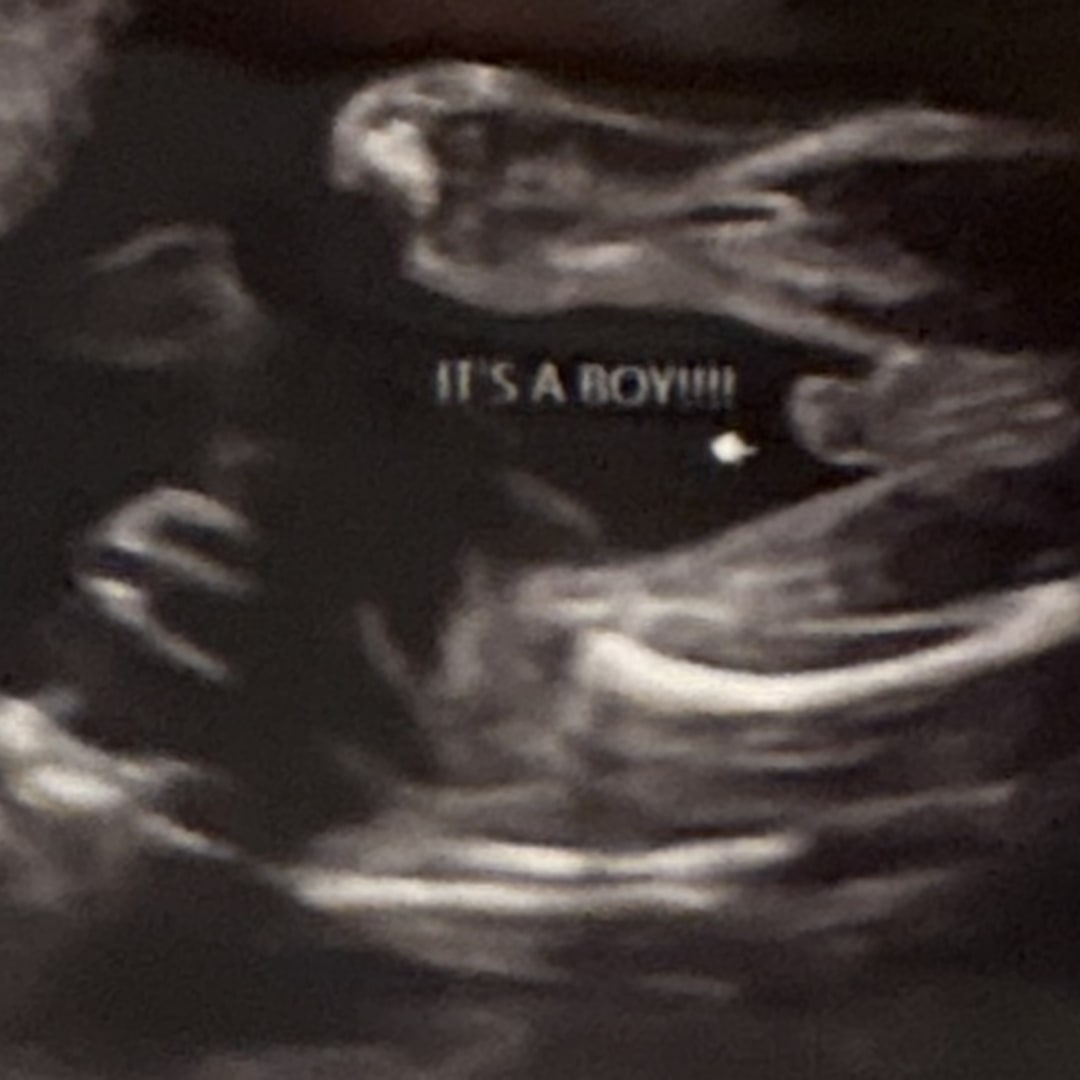Photo shared by Bree for their Babylist baby registry.