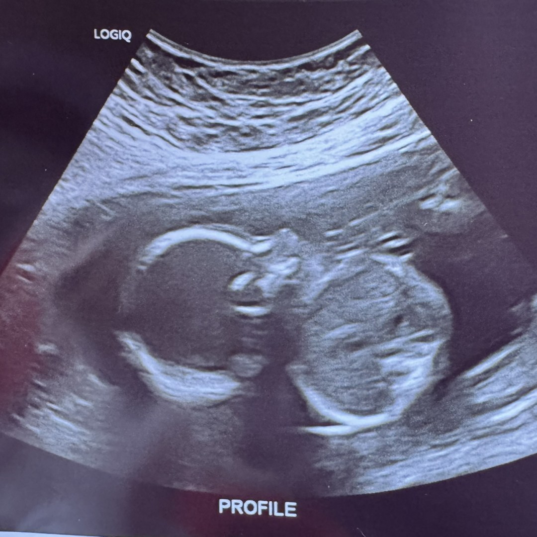Photo shared by Jenna for their Babylist baby registry.
