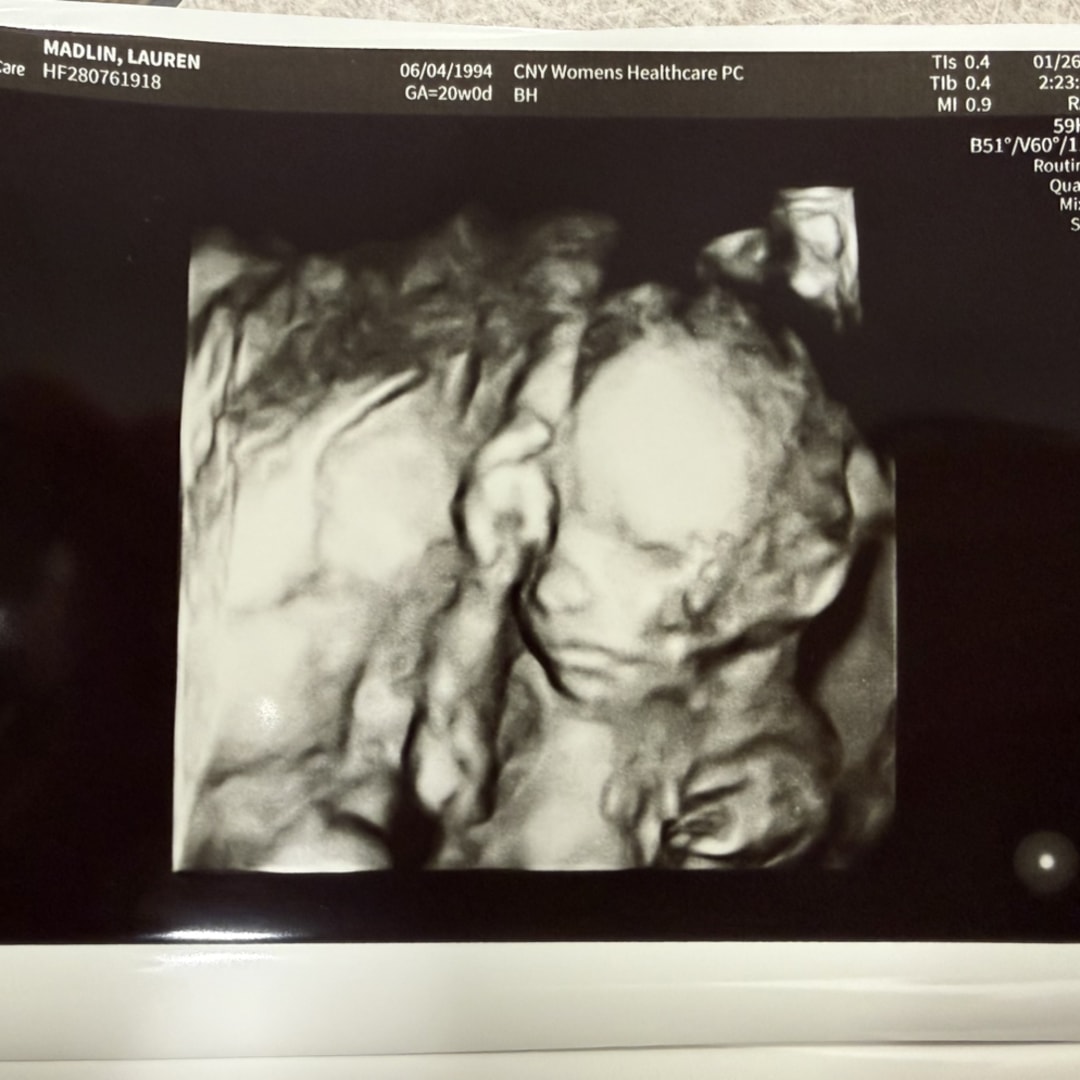 Photo shared by Lauren for their Babylist baby registry.