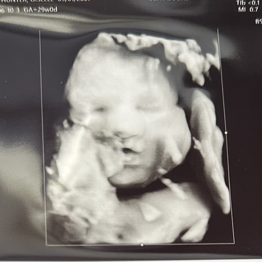 Photo shared by Giselle for their Babylist baby registry.