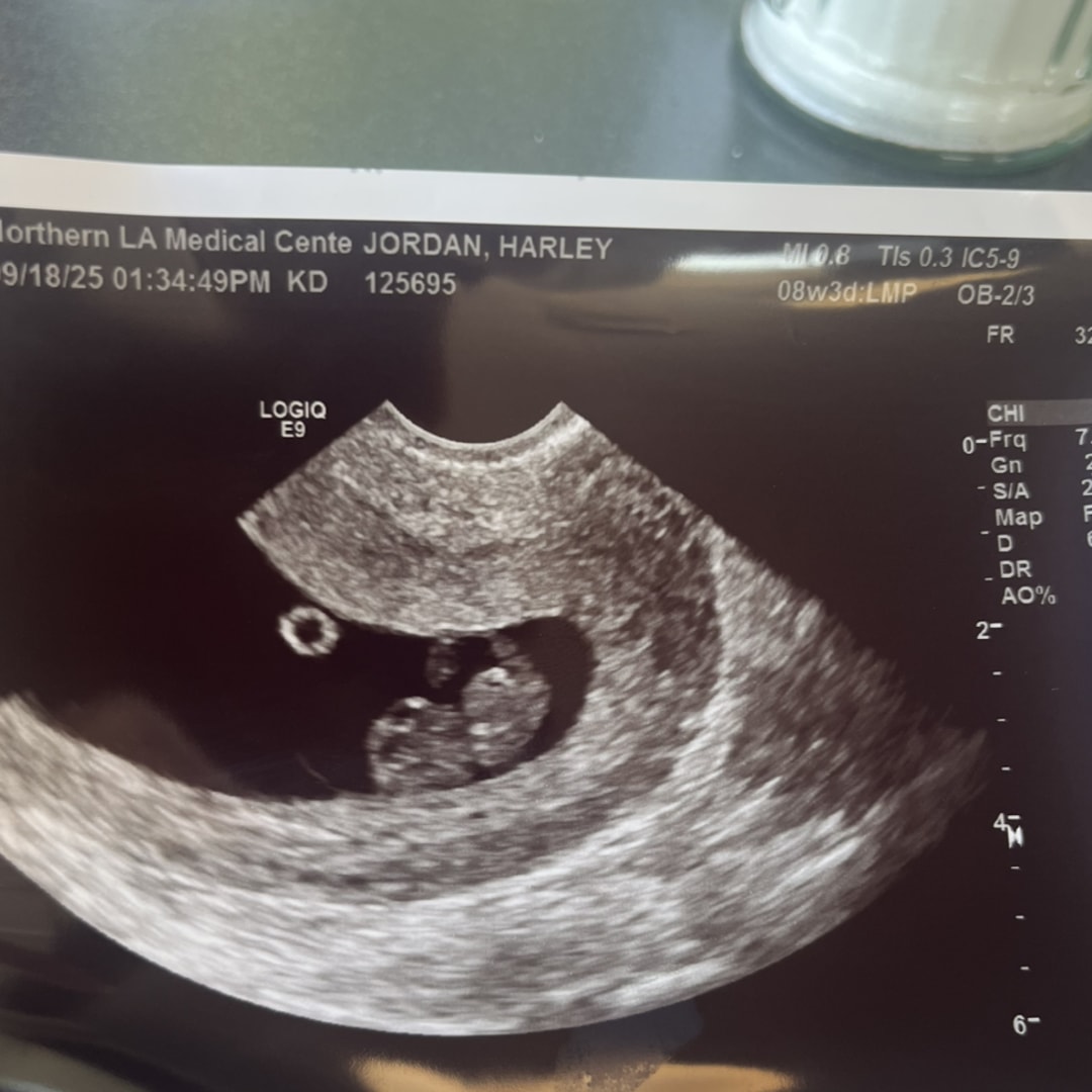 Photo shared by Harley for their Babylist baby registry.