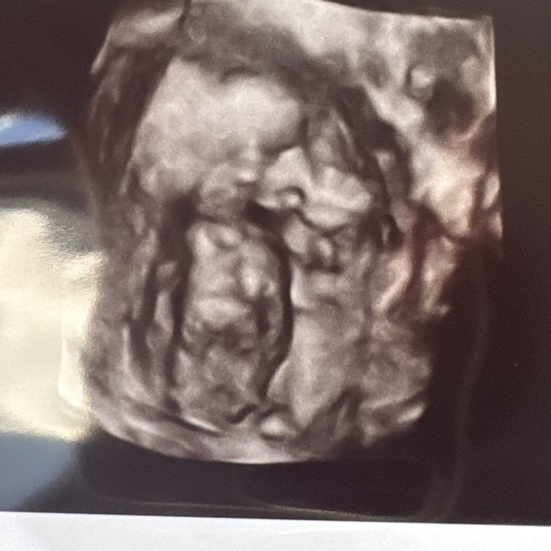 Photo shared by Carol for their Babylist baby registry.