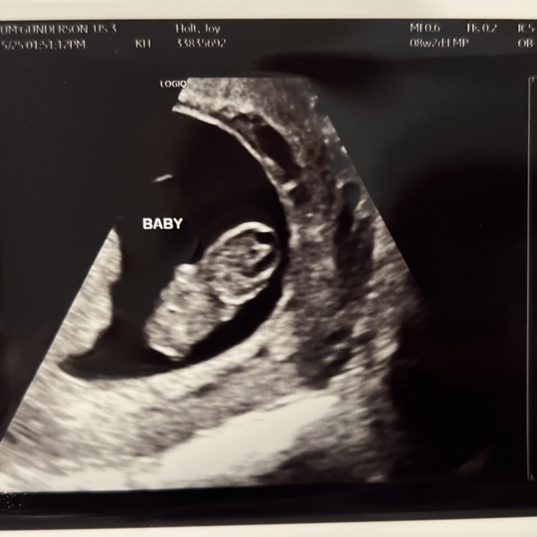 Photo shared by Joy for their Babylist baby registry.