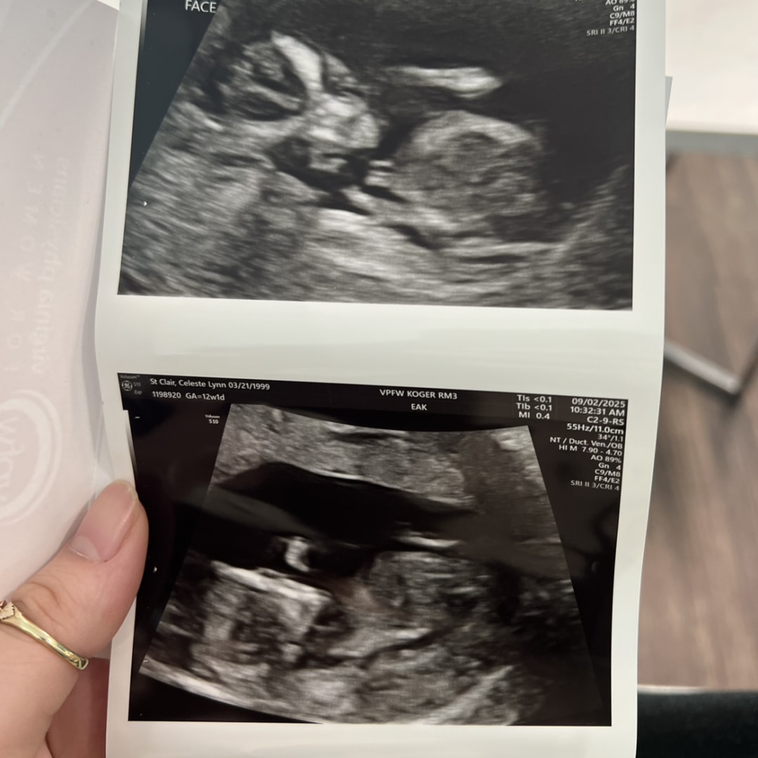 Photo shared by Celeste for their Babylist baby registry.