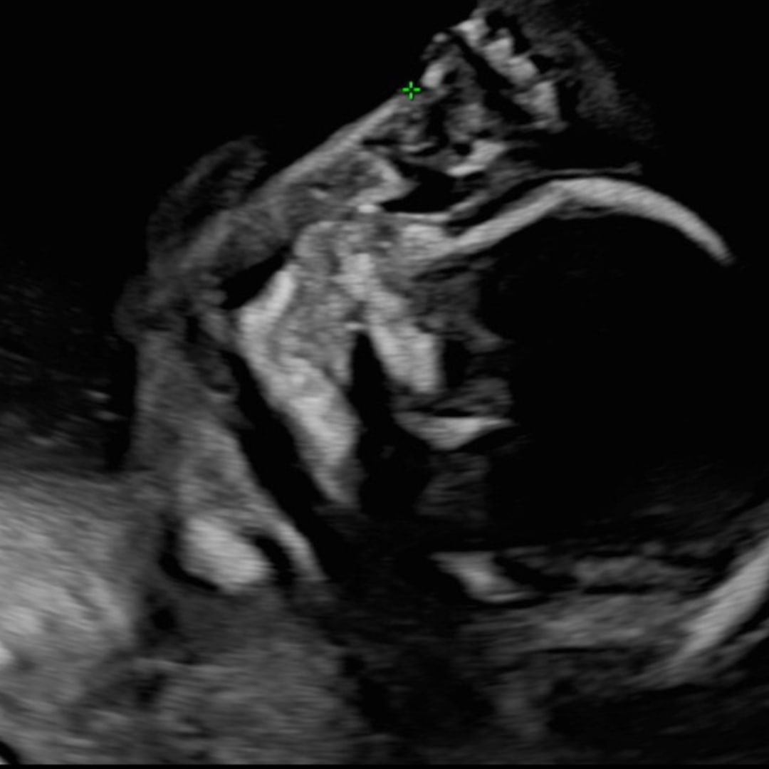 Photo shared by Mackenzie for their Babylist baby registry.