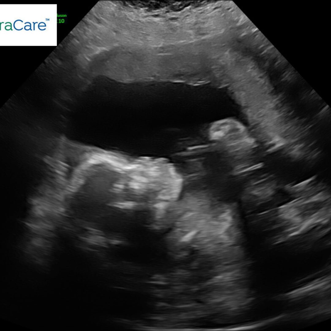 Photo shared by Karlene for their Babylist baby registry.