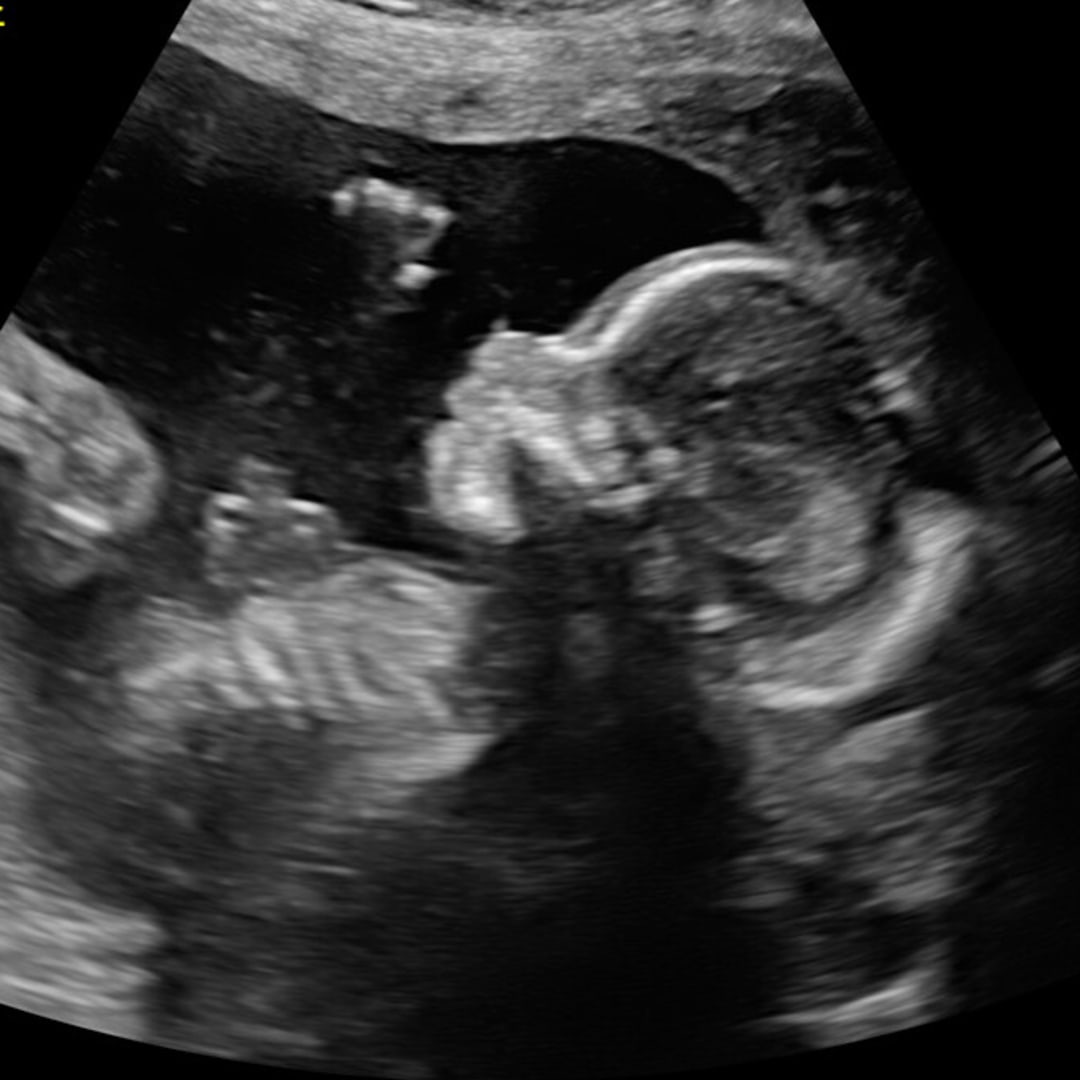 Photo shared by Eryn for their Babylist baby registry.