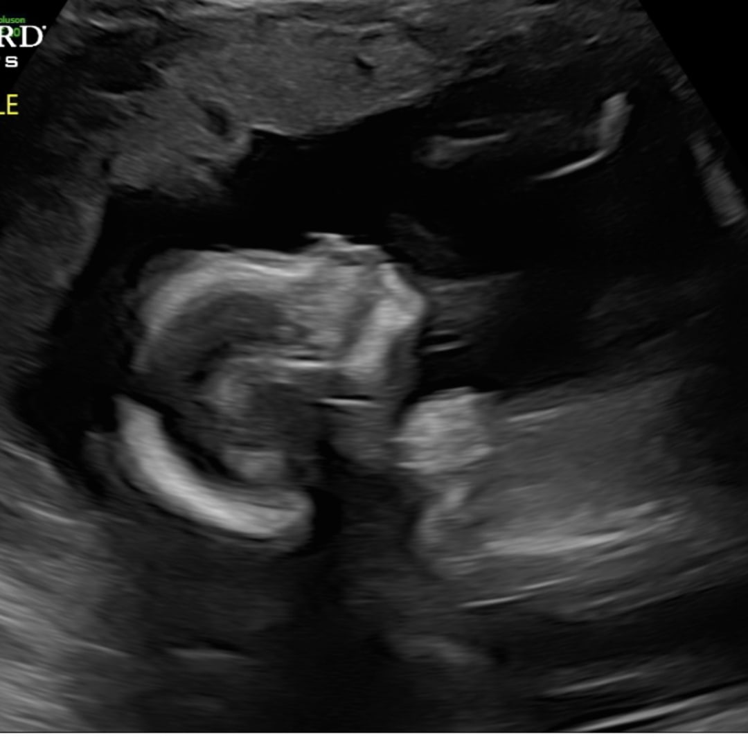 Photo shared by Katie for their Babylist baby registry.