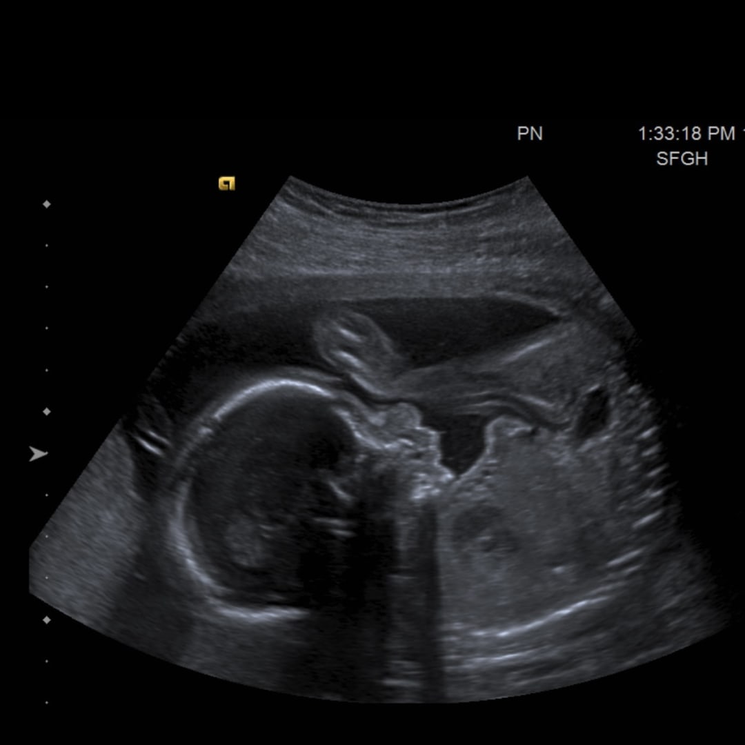 Photo shared by Celina for their Babylist baby registry.
