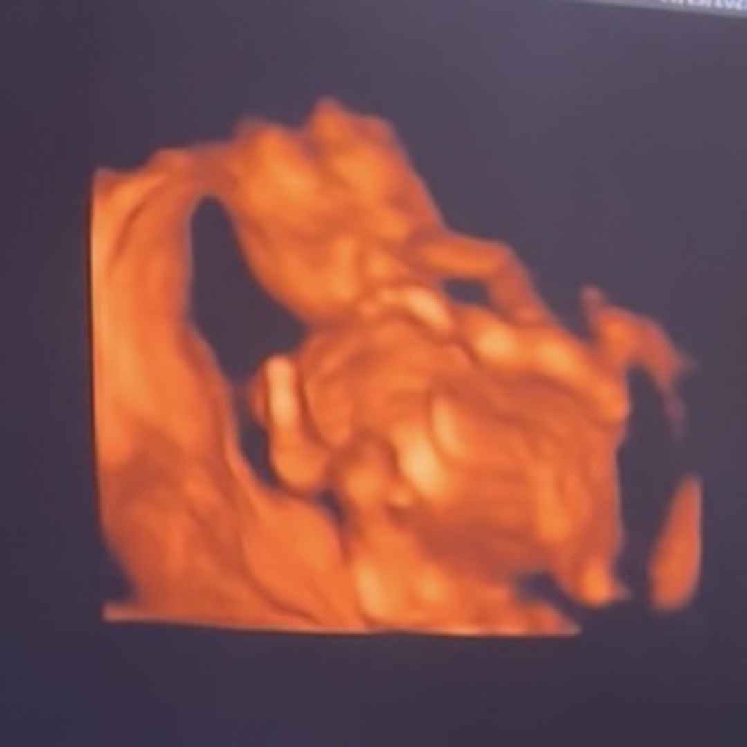 Photo shared by Christina for their Babylist baby registry.