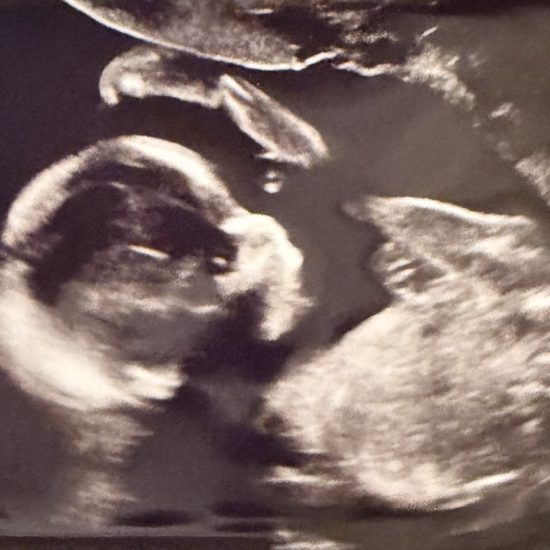 Photo shared by Samantha for their Babylist baby registry.