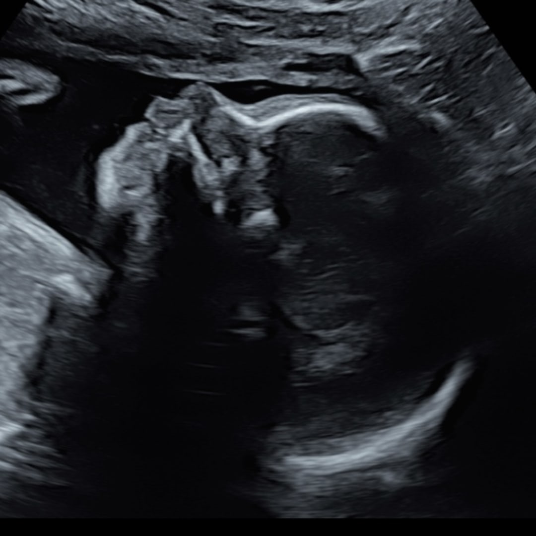 Photo shared by Ava for their Babylist baby registry.