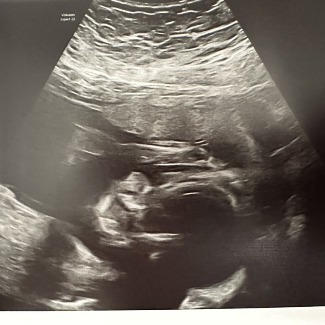 Photo shared by Vee for their Babylist baby registry.
